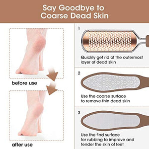 Oneleaf 2PCS Professional Pedicure Rasp Foot File Cracked Skin Corns Callus Remover for Extra Smooth and Beauty Foot … (Rose)